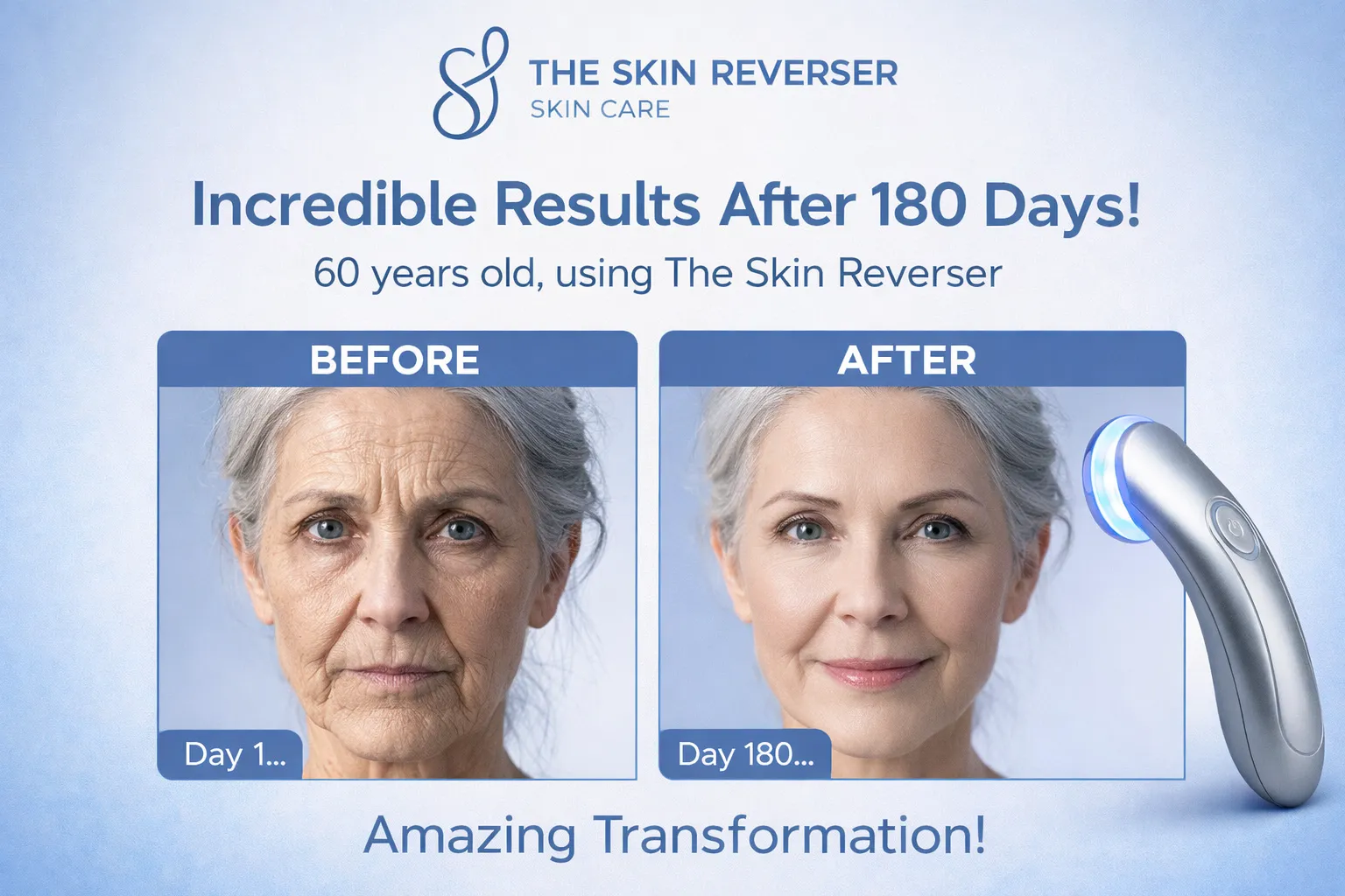 Skin Reverser Feature Diagram 3